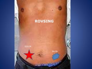 ROVSING
PALPA
DOLOR
 