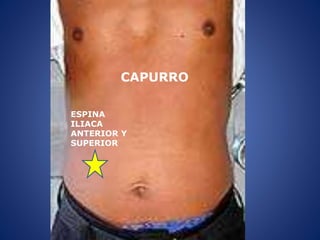 CAPURRO
ESPINA
ILIACA
ANTERIOR Y
SUPERIOR
 