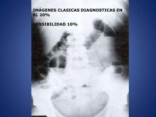 IMÁGENES CLASICAS DIAGNOSTICAS EN
EL 20%
SENSIBILIDAD 10%
 