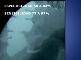 ESPECIFICIDAD 50 A 84%
SENSIBILIDAD 77 A 97%
 