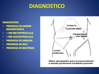 DIAGNOSTICO
PARACENTESIS
• PRESENCIA DE SANGRE
MACROSCOPICA
• + 100 000 ERITROS/mm3
• + 500 LEUCOCITOS/mm3
• PRESENCIA DE AMILASA
• PRESENCIA DE BILIS
• PRESENCIA DE BACTERIAS
 