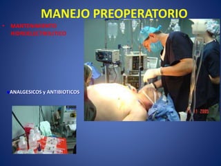 MANEJO PREOPERATORIO
• MANTENIMIENTO
HIDROELECTROLITICO
ANALGESICOS y ANTIBIOTICOS
 
