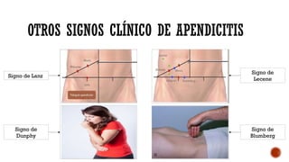 Abdomen agudo quirurgico y no quirurgico | PPTX