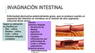 Abdomen agudo adulto | PPTX