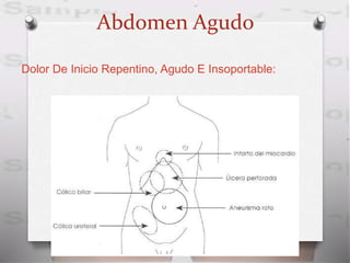 Abdomen Agudo
Dolor De Inicio Repentino, Agudo E Insoportable:
 