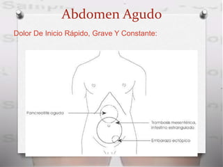 Abdomen Agudo
Dolor De Inicio Rápido, Grave Y Constante:
 
