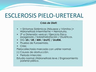 ESCLEROSIS PIELO-URETERAL
 