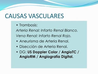 CAUSAS VASCULARES
 
