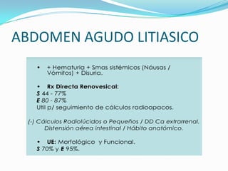 ABDOMEN AGUDO LITIASICO
 