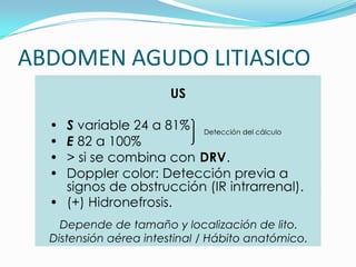 ABDOMEN AGUDO LITIASICO
 