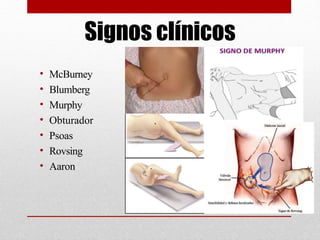 Abdomen Agudo y sus caracteristicas basicas | PPTX