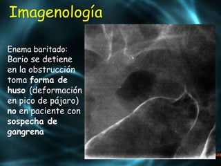 Imagenología
Enema baritado:
Bario se detiene
en la obstrucción
toma forma de
huso (deformación
en pico de pájaro)
no en paciente con
sospecha de
gangrena
 