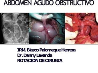 IRM.BlascoPalomequeHerrera
Dr.DannyLavanda
ROTACIONDECIRUGIA
ABDOMEN AGUDO OBSTRUCTIVO
 