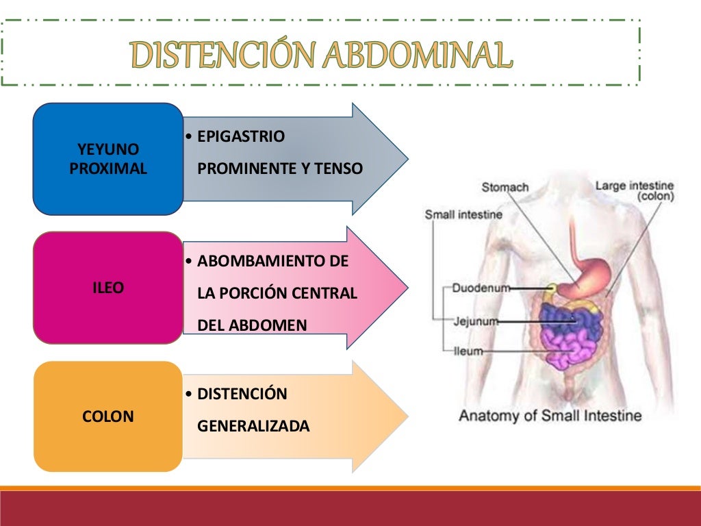 Abdomen agudo obstructivo