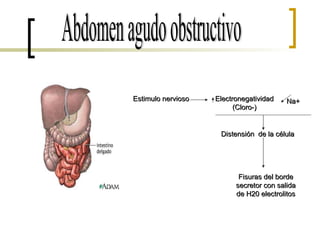 Abdomen agudo obstructivo Estimulo nervioso Electronegatividad (Cloro-) Na+ Distensión  de la célula  Fisuras del borde secretor con salida de H20 electrolitos 