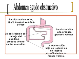 Abdomen agudo obstructivo La obstrucción en el piloro provoca vómitos ácidos La obstrucción por debajo del duodeno  produce vomito neutro o alcalino La obstrucción alta produce grandes vómitos. La obstrucción baja se traduce en un intenso estreñimiento con menos vómito . 