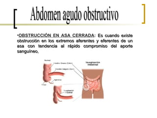Abdomen agudo obstructivo OBSTRUCCIÓN EN ASA CERRADA :   Es cuando existe obstrucción en los extremos aferentes y eferentes de un asa con tendencia al rápido compromiso del aporte sanguíneo , 