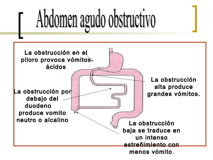 Abdomen Agudo Obstructivo Seminario