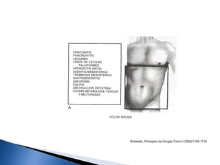 Schwarts, Principios de Cirugía Tomo I (2000)1105-1116
 
