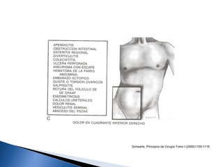 Schwarts, Principios de Cirugía Tomo I (2000)1105-1116
 