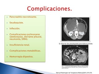 Manual Washington de Terapéutica Médica(2007),374-376.
 