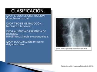 Zubirán, Manual de Terapéutica Médica(2006)189-193
 