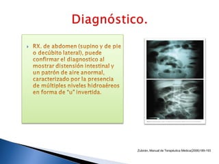 Zubirán, Manual de Terapéutica Médica(2006)189-193
 