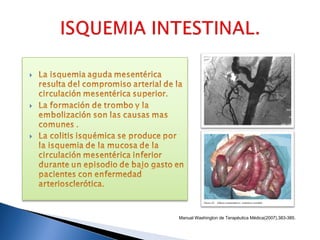 Manual Washington de Terapéutica Médica(2007),383-385.
 