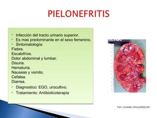 
  Infección del tracto urinario superior.

  Es mas predominante en el sexo femenino.
 Sintomatología:

Fiebre.
Escalofríos.
Dolor abdominal y lumbar.
Disuria.
Hematuria.
Nauseas y vomito.
Cefalea.
Diarrea.
 Diagnostico: EGO, urocultivo.

 Tratamiento: Antibioticoterapia





                                              Ferri, Consultor Clínico(2002),391..
 