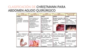 CLASIFICACIÓN DE CHRISTMANN PARA
ABDOMEN AGUDO QUIRÚRGICO
 
