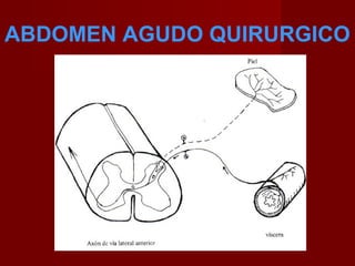 ABDOMEN AGUDO QUIRURGICO
 
