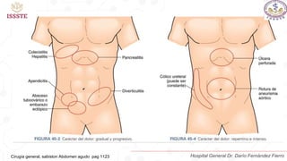 Cirugía general, sabiston Abdomen agudo pag 1123 Hospital General Dr. Darío Fernández Fierro
 