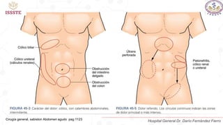 Cirugía general, sabiston Abdomen agudo pag 1123
Hospital General Dr. Darío Fernández Fierro
 