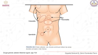 Cirugía general, sabiston Abdomen agudo pag 1123 Hospital General Dr. Darío Fernández Fierro
 