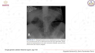 Cirugía general, sabiston Abdomen agudo pag 1123
Hospital General Dr. Darío Fernández Fierro
 