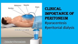 Surgical aspects of abdomen - made by Srikar | PPTX