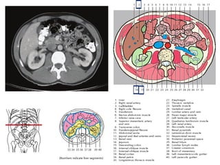 Comprehensive Sectional Anatomy of the Abdomen with Vascular and Organ ...