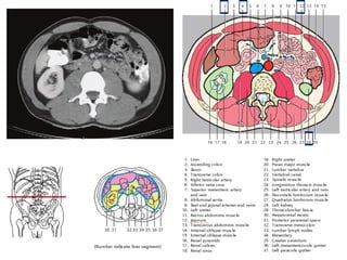 Comprehensive Sectional Anatomy of the Abdomen with Vascular and Organ ...