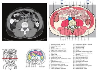 Comprehensive Sectional Anatomy of the Abdomen with Vascular and Organ ...