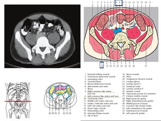 Comprehensive Sectional Anatomy of the Abdomen with Vascular and Organ ...