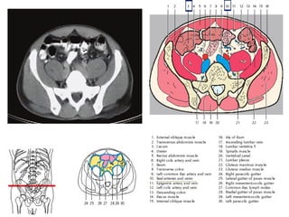 Comprehensive Sectional Anatomy of the Abdomen with Vascular and Organ ...