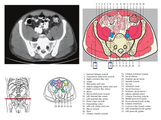 Comprehensive Sectional Anatomy of the Abdomen with Vascular and Organ ...