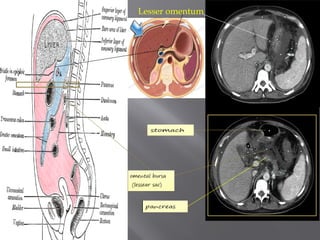 Left Submentrum Comprehensive Sectional Anatomy of the Abdomen with Vascular and Organ ...