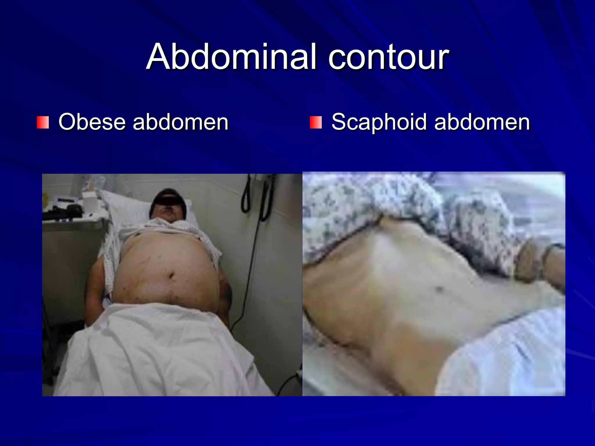 Abdomen Examination Ms 2021 PDF