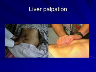 Liver palpation
 