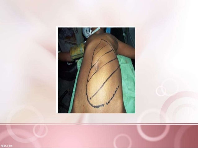 Abdomen Examination Paeds