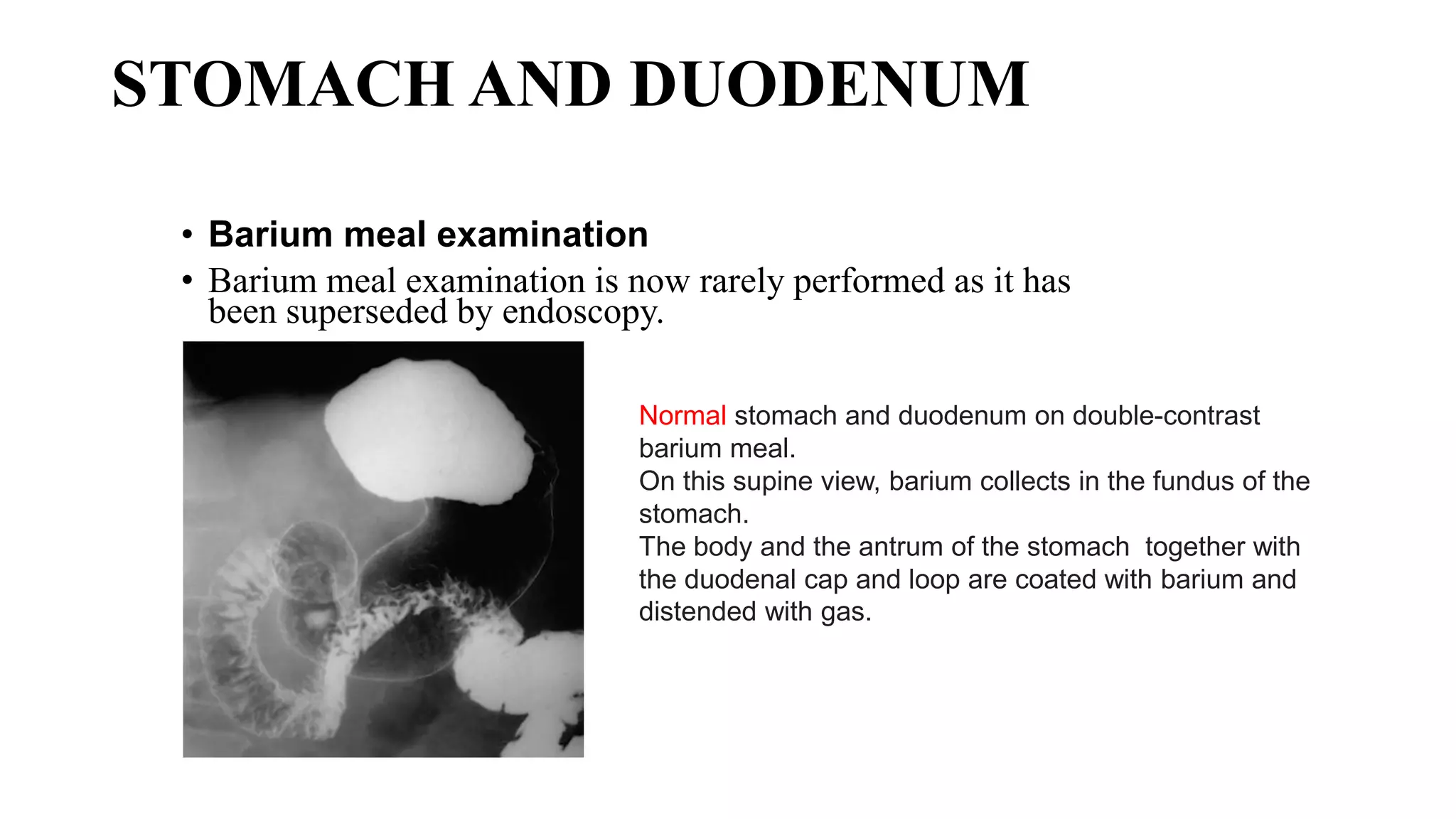 Abdomen Gastrointestinal tract.pptx