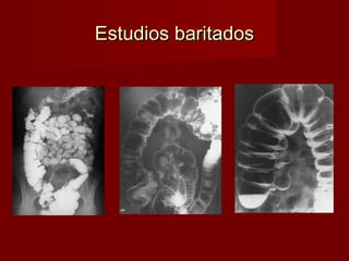Abdomen ii | PPT
