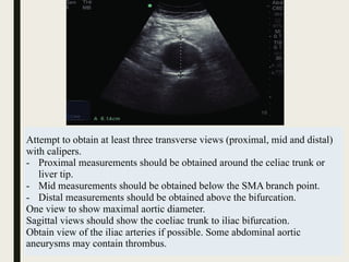 Abdomen II - Abdominal Aorta and Inferior Vena Cava.pdf