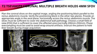 Abdomen MRI Protocol Planing.pptx Abdomen MRI Protocol Planing.pptx
